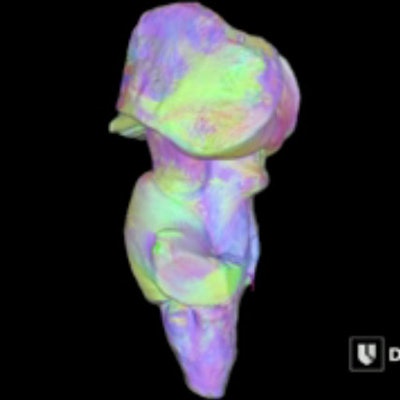 Scientists at Duke have produced a 3D map of the human brainstem. Image courtesy of Dr. Evan Calabrese, Duke Medicine.