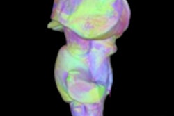 2015 06 04 10 56 32 965 Brainstem 200