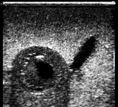 Transverse-magnified view of the cherry.