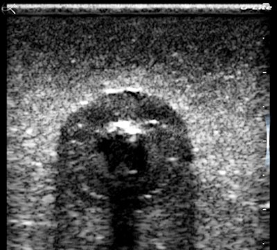 Oblique-magnified view of the cherry.