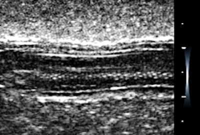 Long-axis view of a gherkin.