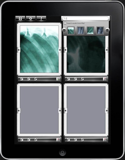 Viewbox users can organize their teaching file images and create presentations. Images courtesy of Dr. Luther Adair II.