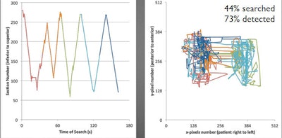 Images above represent the 'driller' reading paradigm; images below represent the 'scanner' paradigm. Upper left, driller reads different lung regions in a more efficient manner than a scanner (bottom left), who moves left to right and back in a scattershot approach, repeating some regions and neglecting others. The driller covers more anatomy and finds more nodules (upper right) than the scanner (lower right). All images courtesy of Dr. Geoffrey Rubin.