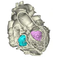 2015 06 26 13 12 23 805 2015 06 26 3 D Heartmodel 200