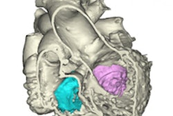 2015 06 26 13 12 23 805 2015 06 26 3 D Heartmodel 200