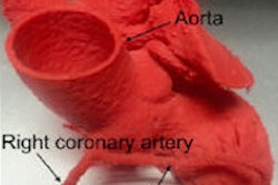 2015 07 16 15 09 38 992 2015 07 Anomalous Coronaries 200
