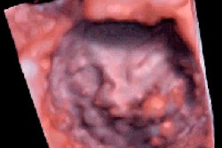 2015 07 24 13 06 49 304 C Sound Mitral Valve 200