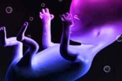 2015 08 07 12 26 43 372 Human Fetus 200