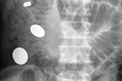 2015 09 04 09 11 30 237 Figure 1 Bullet 400 20150904165138