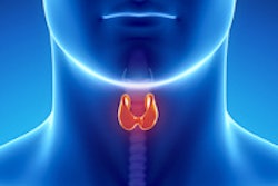 2015 09 08 16 18 29 573 Thyroid 200