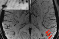 2015 09 14 18 24 33 988 Tbi Mri 450 20150915012850