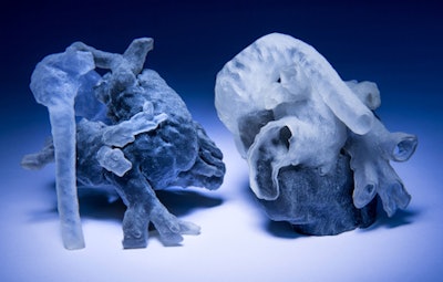 3D-printed heart models created from MRI scans. Image courtesy of MIT and Boston Children's Hospital. Photo credit: Bryce Vickmark.
