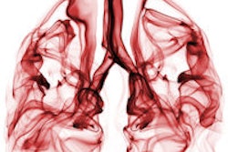 2015 10 02 16 16 58 339 Lungs Smoke 200