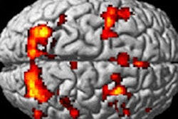 2015 10 05 15 59 21 118 Fmri Concussion Full 200