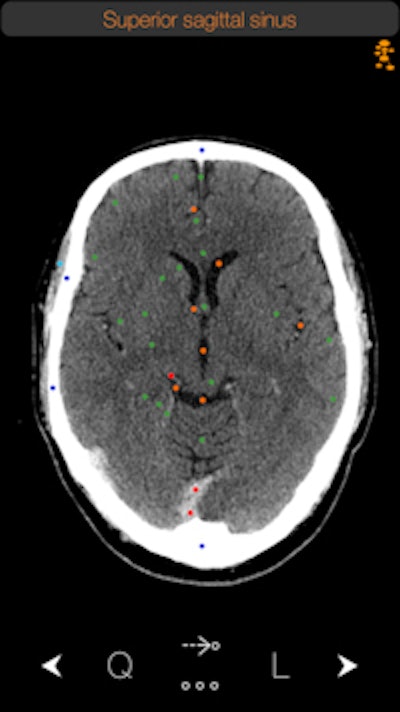 The CT Anatomy app. Image courtesy of iCat Medical.