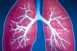 2015 10 22 14 24 52 256 Lung General 200