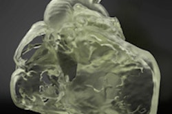 2015 11 03 14 55 43 360 3d Printing Fig8 200