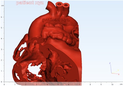 Applying a text label to a heart model using Mimics Innovation Suite.