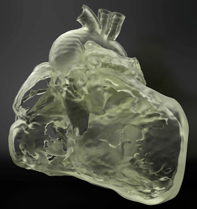 Example of a flexible 3D-printed heart model.