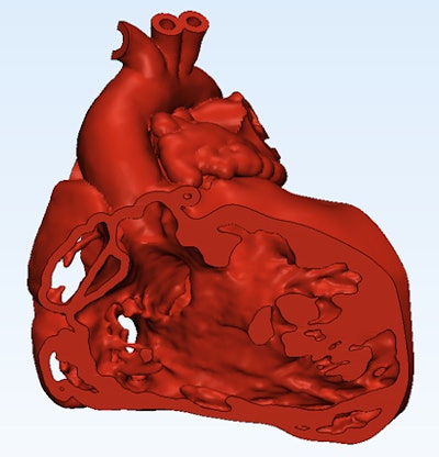 Cutaway view of the heart generated with Mimics Innovation Suite 3D modeling software.