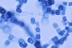 2015 11 13 22 29 48 524 Coccidioides Fungus 200