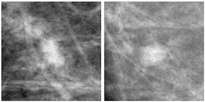 Above, example of malignant (left) and benign (right) mass images shown to pigeons. Below, example of calcification (left) and no-calcification (right) images shown.