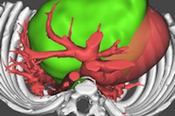 2015 11 18 15 14 30 230 Plasencia Patient C 200