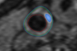 2015 11 23 15 55 33 604 Iph Maraj 200