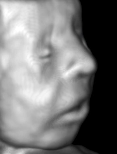 Image courtesy of Dr. Jason Birnholz.