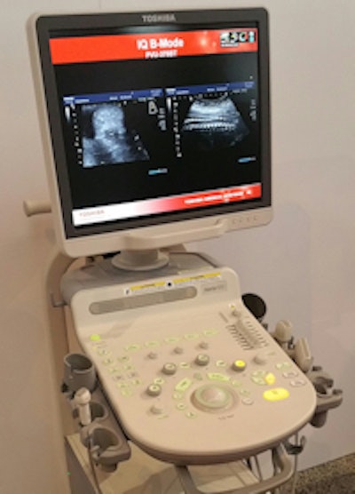 The Xario 100 ultrasound scanner.