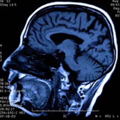 2015 11 12 10 29 21 842 Brain Mri 200