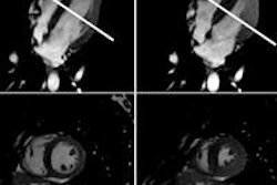 2015 12 01 18 01 41 580 Rsna Dorner Fig 1 450 20151202010517