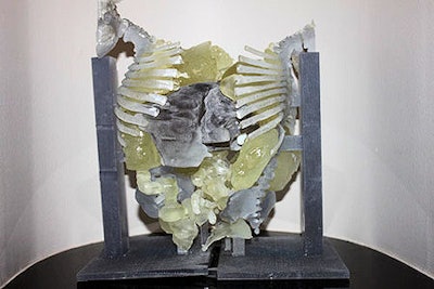 3D-printed model of the twins' conjoined anatomy.