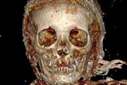2015 12 07 10 42 11 65 2015 10 22 Jfr Mummy Image3 20151207174237