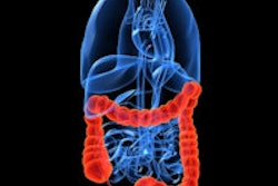 2013 06 11 08 56 40 776 Colon 200