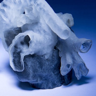 Image courtesy of MIT and Boston Children's Hospital. Photo credit: Bryce Vickmark.