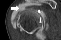 2016 01 06 16 50 05 987 Magee Slide39 Top 400 20160106235730