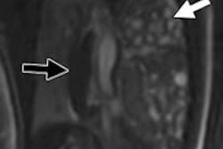 2016 01 11 15 20 12 25 Ajr Victoria Fetal Mri B 200