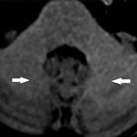 Image courtesy of Kanda et al, May 5, 2015, and Radiology.