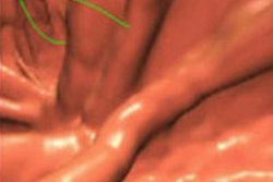 2016 01 20 11 33 44 27 2016 01 Nappi Thumbnail 200