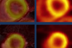 2016 01 21 12 03 35 566 Pet Mri Durrani 200