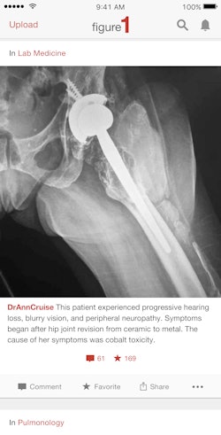 Figure 1 users can upload, review, and discuss deidentified cases. All images courtesy of Dr. Joshua Landy.