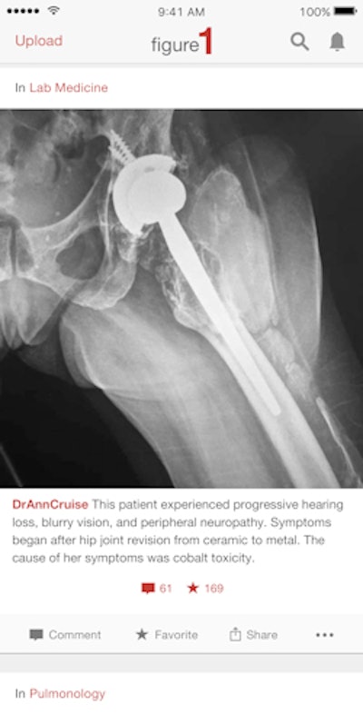 Figure 1 users can upload, review, and discuss deidentified cases. All images courtesy of Dr. Joshua Landy.