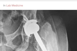 2016 01 21 17 46 26 552 Figure1 Screenshot 200