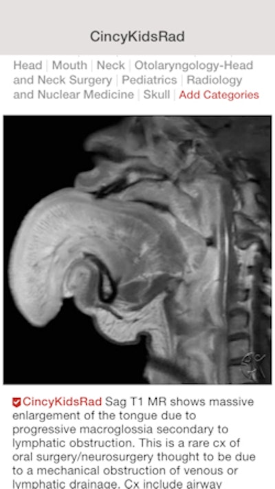 Pediatric radiology cases are featured on a Figure 1 group run by Cincinnati Children's Hospital Medical Center.