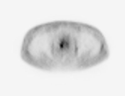 Ac Prostate
