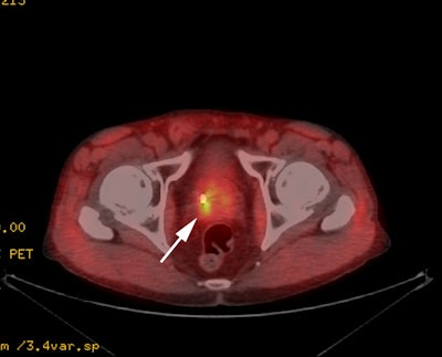 Fused Axial