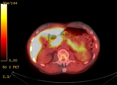 Liver And Pancreas