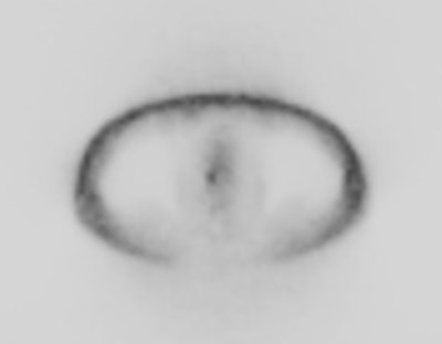 Nac Image Prostate