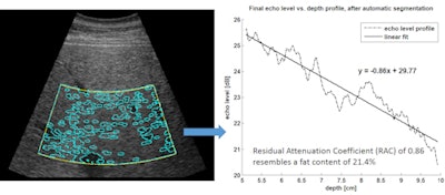 Computer-assisted ultrasound software automatically marks the region of interest (yellow lines) and performs automatic segmentation (blue lines). The resulting echo level versus depth profile enables calculation of the residual attenuation coefficient and estimation of fat content percentage. Image courtesy of Gert Weijers.